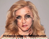 Розбите обличчя Мадонни шокувало шанувальників