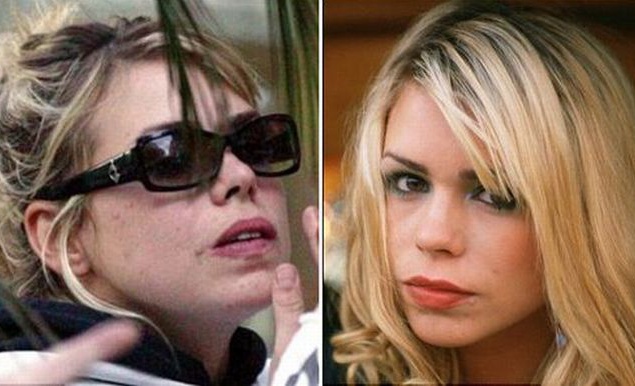 А вот певица Билли Пайпер свей проблемной кожи не стесняется. Девушку часто можно увидеть на улице без макияжа. А вот певица Билли Пайпер свей проблемной кожи не стесняется. Девушку часто можно увидеть на улице без макияжа.