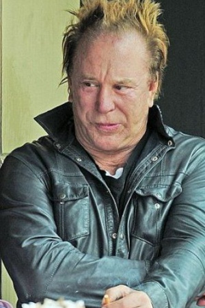 Привлекает внимание также неестественная линия роста волос. Ну? и, если посмотреть на более ранние фотографии звезды, то тайное станет совсем уж очевидным.