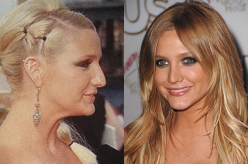 9. Эшли Симпсон сделала ринопластику не из-за прихоти: носовая перегородка мешала ей дышать. Хотя многие считают, что это всего лишь отговорка, ведь нос Эшли трудно назвать идеальным. После операции Эшли стала ещё больше похожа на свою сестру Джессику, ко