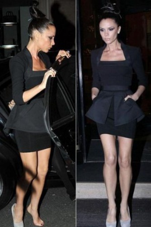 Виктория Бэкхэм — не только икона стиля, но и обладательница титула "Самые жуткие ноги Британии". Виной всему — подагрический сустав.