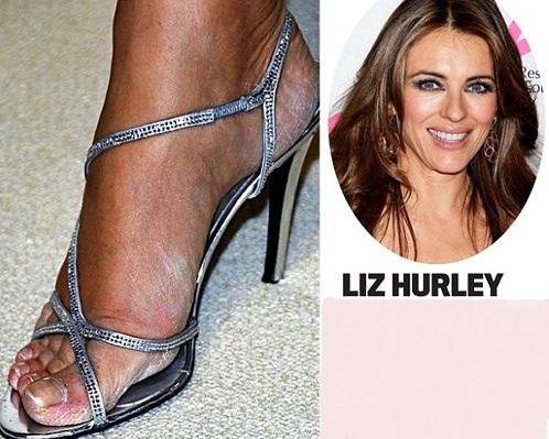 Актриса Элизабет Херли частенько забывает о педикюре и базовых гигиенических процедурах: ее ступни покрыты натоптышами и сухой шелушащейся кожей.