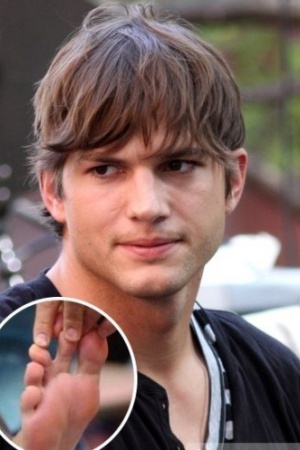 От рождения между двумя пальцами ноги есть перепонка От рождения между двумя пальцами ноги есть перепонка