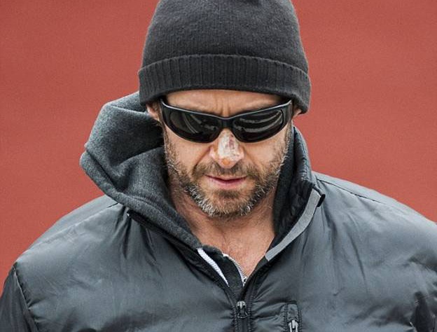 Между тем Хью до сих пор проходит лечение от рака кожи, который был у него выявлен в прошлом месяце на носу. Однако по сообщениям, у актера есть все шансы вскоре побороть грозное заболевание и вернутся к своей работе. В частности, сейчас ведутся переговор