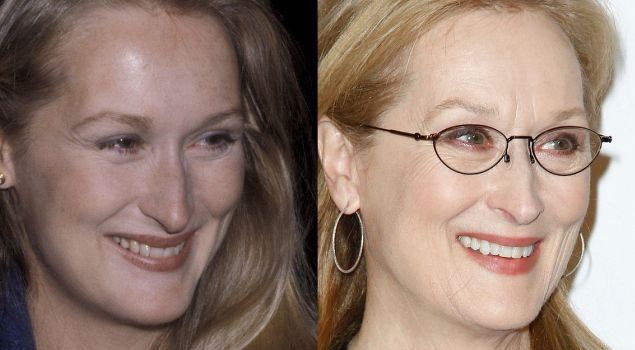 Мерил Стрип, 65. В 1979 и сейчас