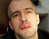 Вячеслав Разбегаев получил серьезную травму лица