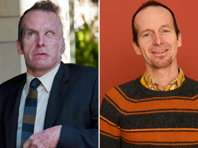 Дэнис О'Харе играет безработного с тяжелыми ожогами Ларри Харви (1-й сезон) Дэнис О'Харе играет безработного с тяжелыми ожогами Ларри Харви (1-й сезон)