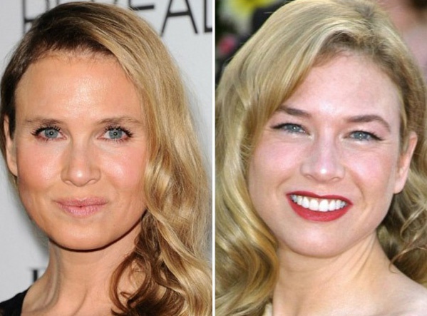 Напомним, некоторое время назад не менее известная голливудская актриса Рене Зеллвегер стала предметом осуждения. Несмотря на то, что звезда "Дневника Бриджит Джонс" отрицает факт вмешательства пластических хирургов и косметологов, результат, как говоритс