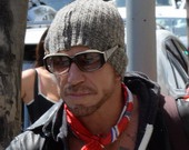 Микки Рурк снова сделал пластику