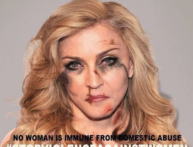 Разбитое лицо Мадонны шокировало поклонников 