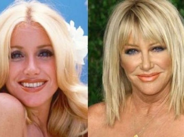 Сьюзан Сомерс