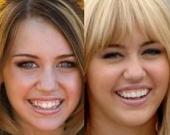 Майли Сайрус "подправили" улыбку