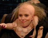 Скарлетт Йохансон изуродовали