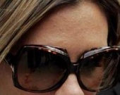 Виктория Бекхэм покрылась ужасной сыпью!