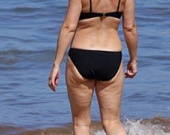 Летнее обострение целлюлита у знаменитостей