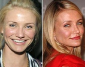 Самые лучшие исправленные носы: эволюция звездных лиц