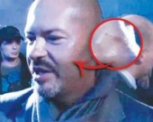 Бондарчуку расцарапали лысину