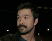 "Параграф 78": актеру отбили почку