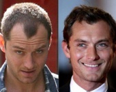 Джуд Лоу лысеет