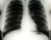 Флюорография Монро ушла с молотка за 45 тысяч долларов